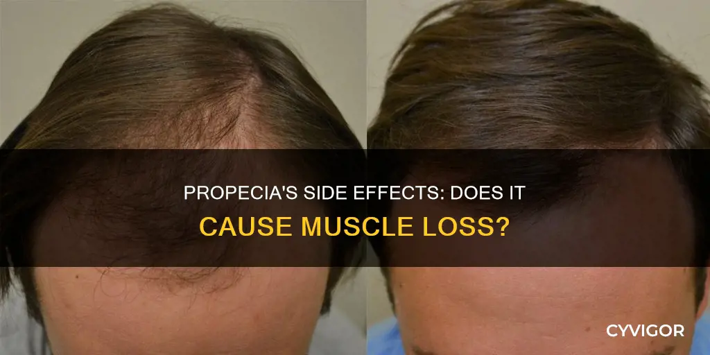 does propecia cause muscle loss