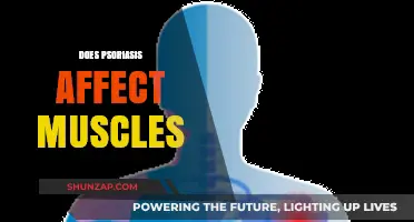 Exploring the Impact of Psoriasis on Muscle Health and Function