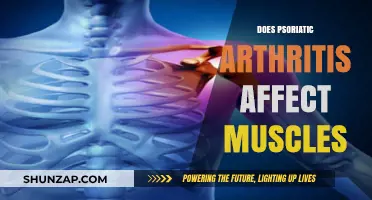 Exploring the Impact of Psoriatic Arthritis on Muscle Health