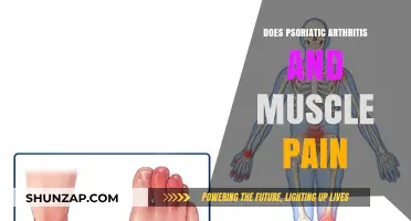 Understanding Psoriatic Arthritis: Its Link to Muscle Pain Explained