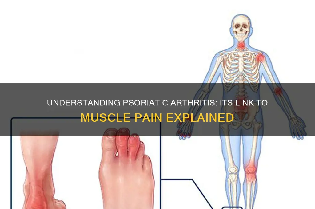 does psoriatic arthritis and muscle pain