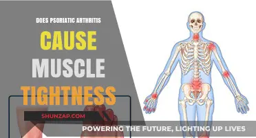 Psoriatic Arthritis: Muscle Tightness and Pain Explained