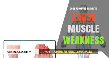 Psoriatic Arthritis: Can It Weaken Your Muscles?