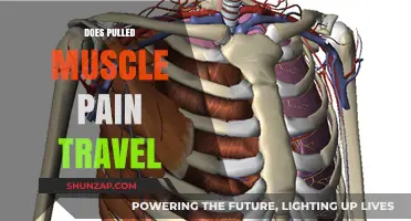 Can Pulled Muscle Pain Radiate to Other Body Areas?