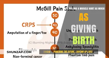 Muscle Pull vs. Childbirth Pain: Which Hurts More?