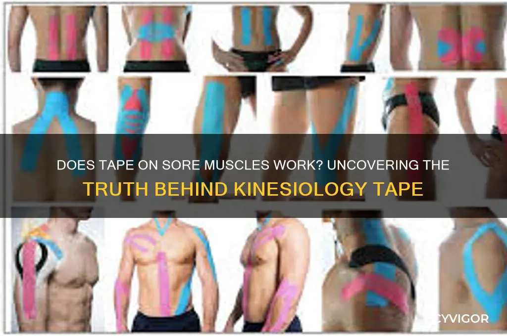 does putting tape on sore muscles work