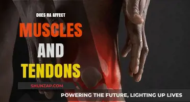Exploring the Impact of RA on Muscles and Tendons: A Comprehensive Guide