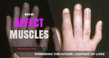 Exploring the Impact of RA on Muscle Health and Function