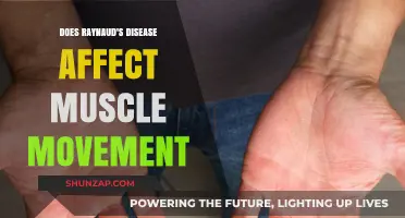 Exploring Raynaud's Disease: Impact on Muscle Mobility and Function