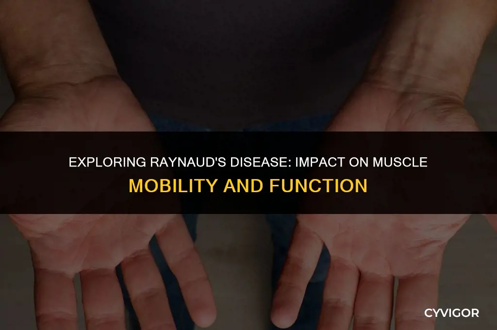 does raynaud