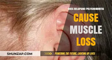 Relapsing Polychondritis: Can It Lead to Muscle Loss?