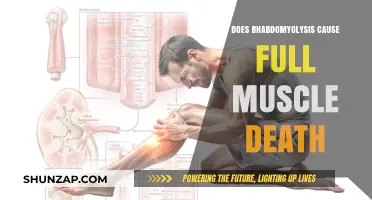Rhabdomyolysis: Can It Kill Your Muscles?