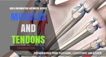 Exploring Rheumatoid Arthritis: Impact on Muscles and Tendons