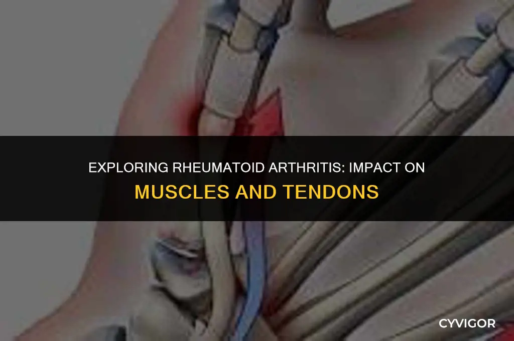 does rheumatoid arthritis affect muscles and tendons