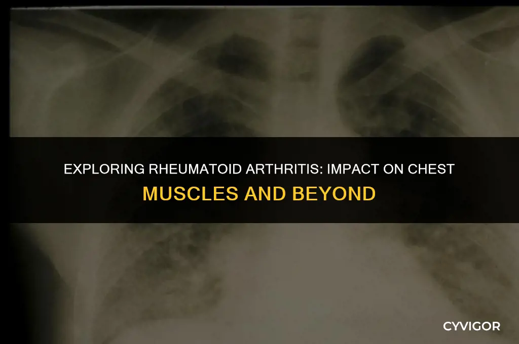 does rheumatoid arthritis affect the chest muscles