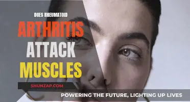 Rheumatoid Arthritis: Muscle Pain and Inflammation Explained