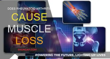 Rheumatoid Arthritis: Muscle Loss and You