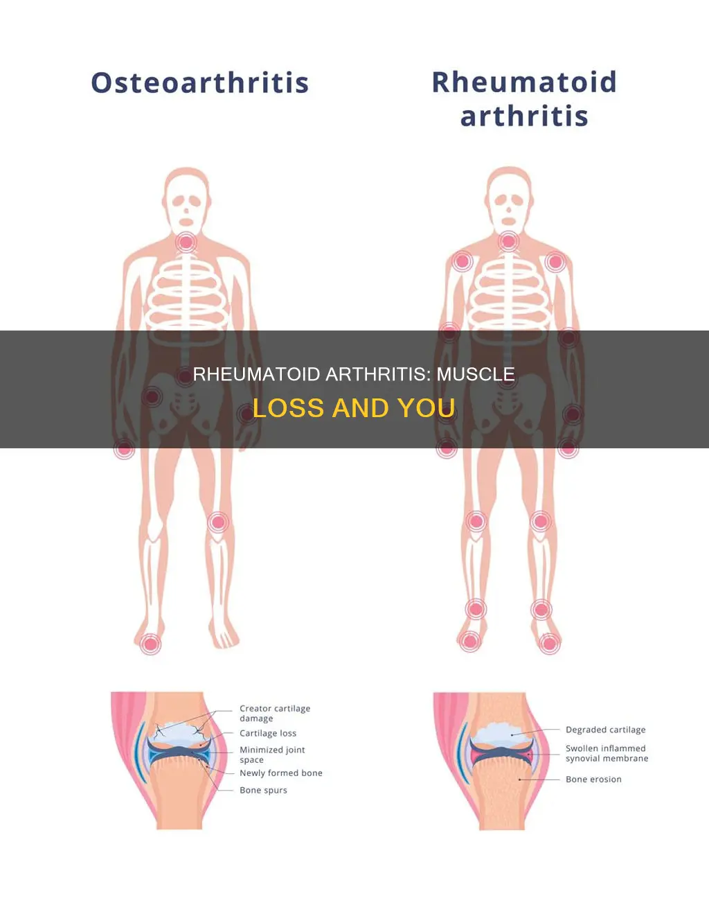 does rheumatoid arthritis cause muscle loss