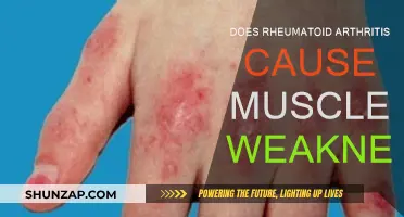 Rheumatoid Arthritis: Muscle Weakness and Fatigue Explained