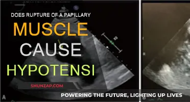 Papillary Muscle Rupture: Hypotension and Heart Function