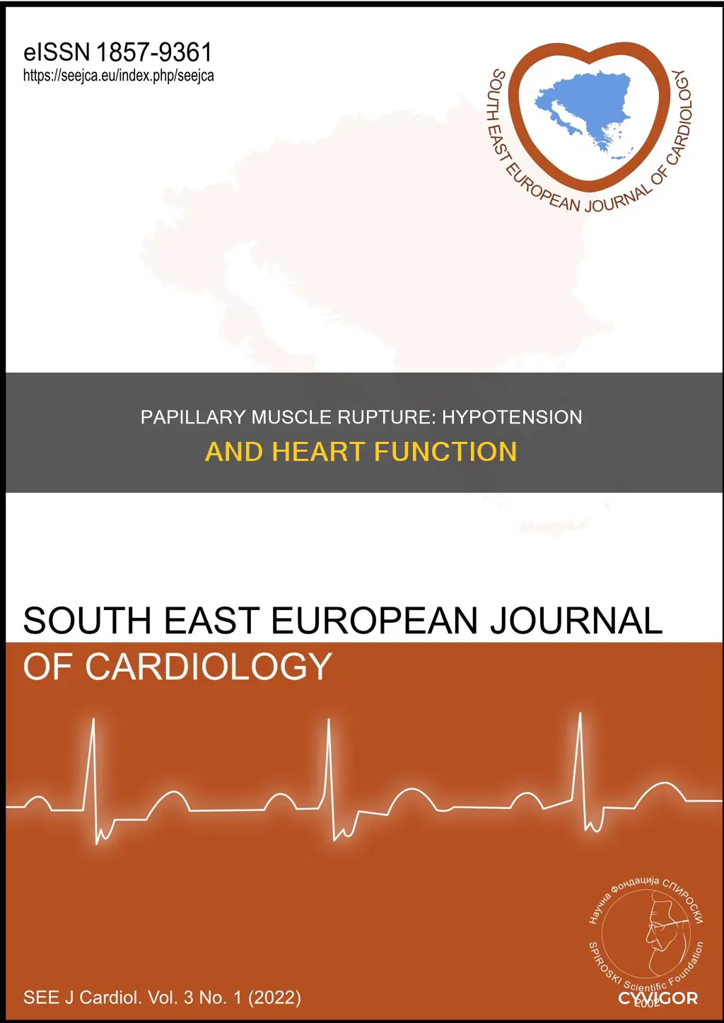 does rupture of a papillary muscle cause hypotension