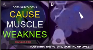 Sarcoidosis and Muscle Weakness: What's the Link?