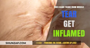Understanding Scar Tissue Inflammation Post-Muscle Tear: Facts and Remedies