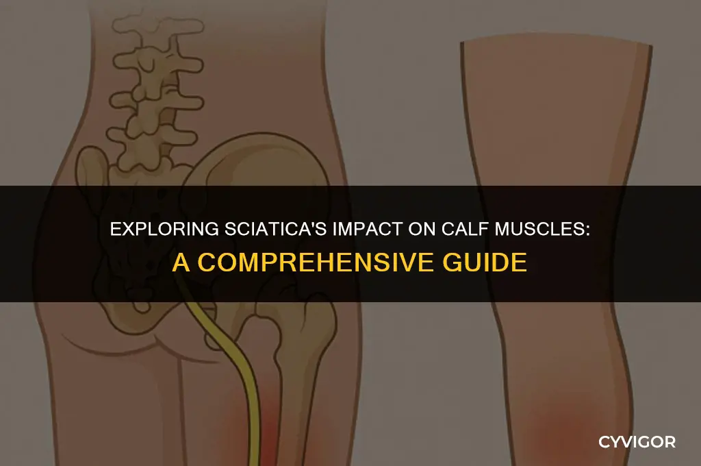 does sciatica affect calf muscle