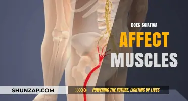 Exploring Sciatica's Impact: How It Affects Your Muscles