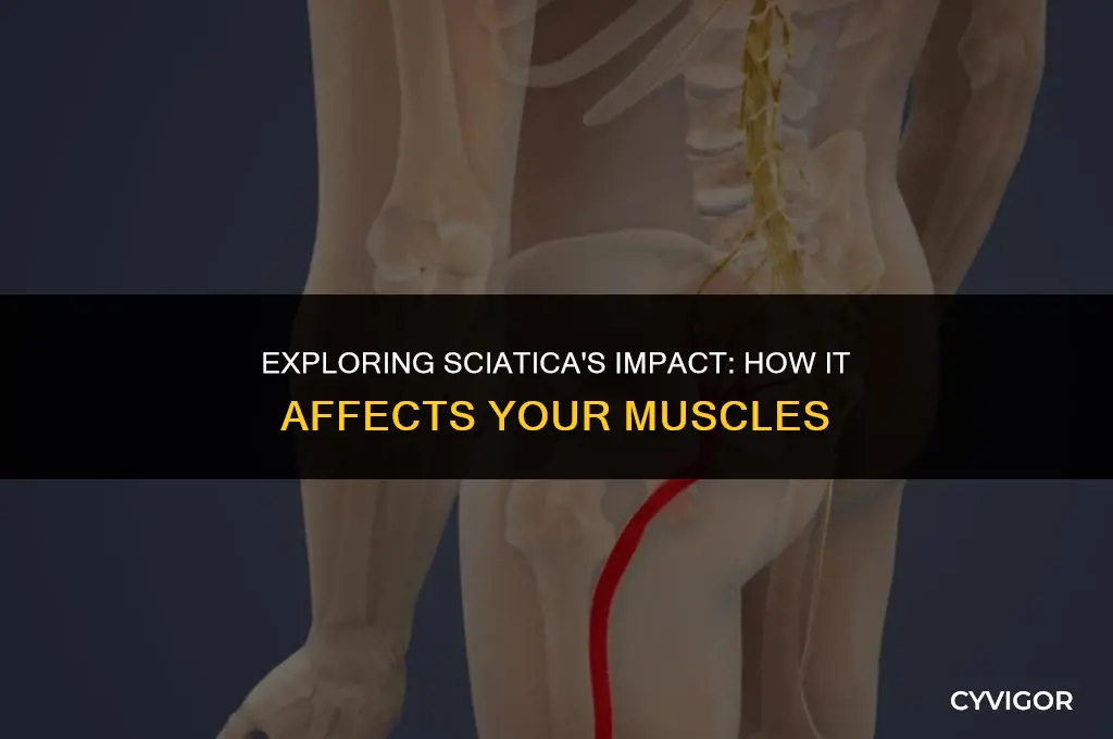 does sciatica affect muscles
