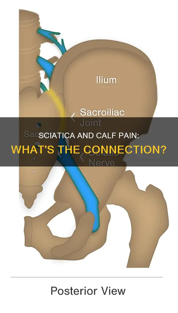 does sciatica cause calf muscle pain