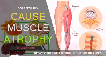 Sciatica and Muscle Atrophy: What's the Connection?