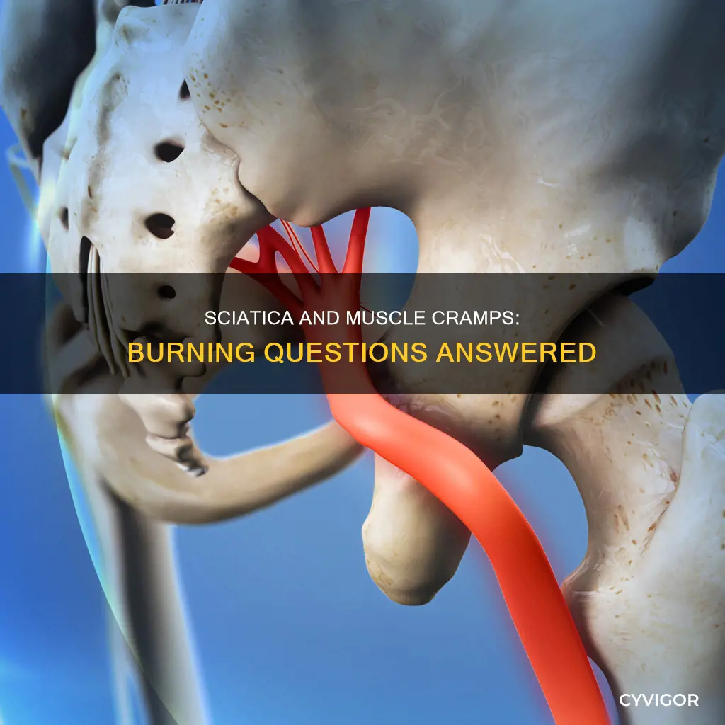 does sciatica cause muscle cramps and burning