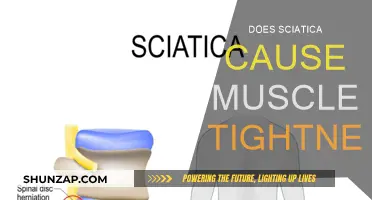 Sciatica and Muscle Tightness: What's the Link?