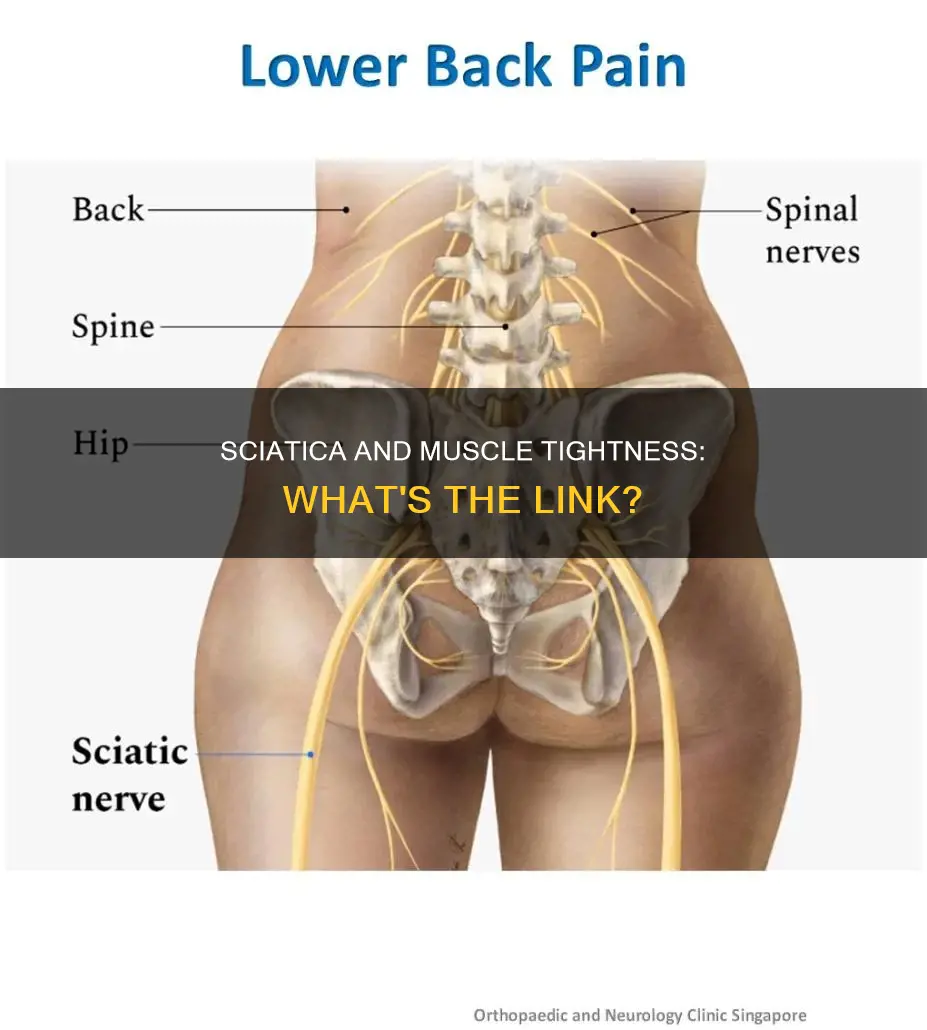 does sciatica cause muscle tightness