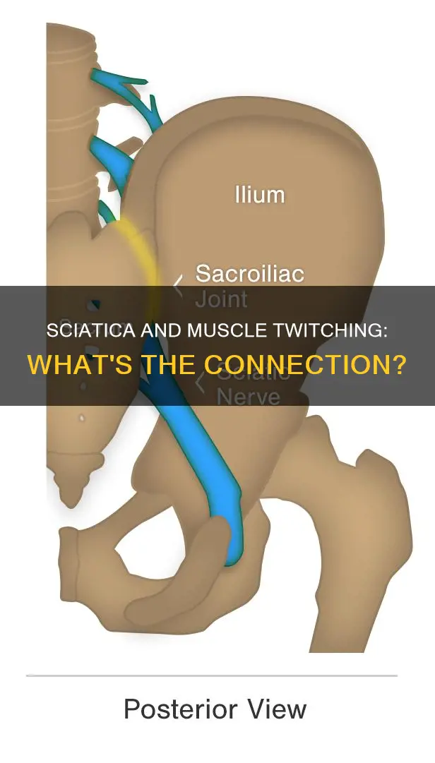 does sciatica cause muscle twitching