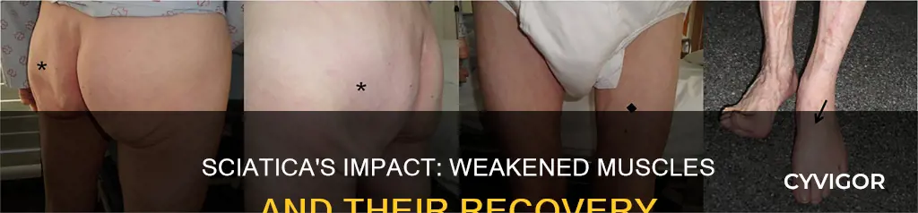 does sciatica weaken muscles