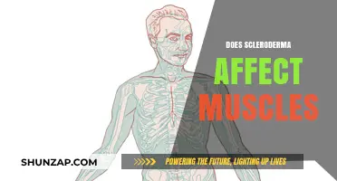 Understanding Scleroderma's Impact on Muscle Health and Function