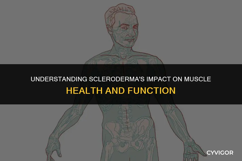 does scleroderma affect muscles