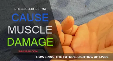 Scleroderma's Impact: Muscle Damage and You