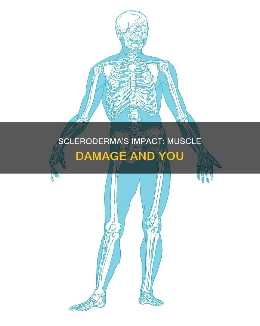 does scleroderma cause muscle damage
