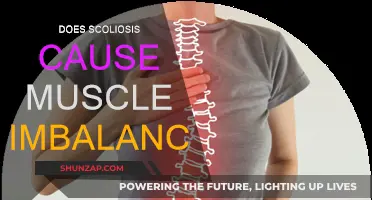 Scoliosis and Muscle Imbalance: What's the Link?