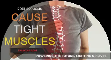 Tight Muscles and Scoliosis: What's the Link?