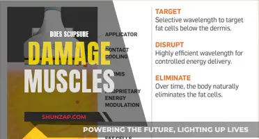 Scuplture's Muscle Damage: What You Need to Know