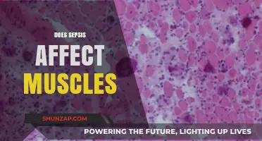 Unraveling the Impact of Sepsis on Muscle Health: A Comprehensive Guide
