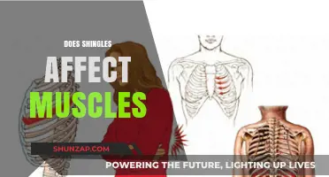 Exploring the Impact of Shingles on Muscle Health