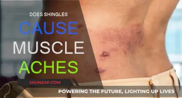 Shingles and Muscle Aches: What's the Link?