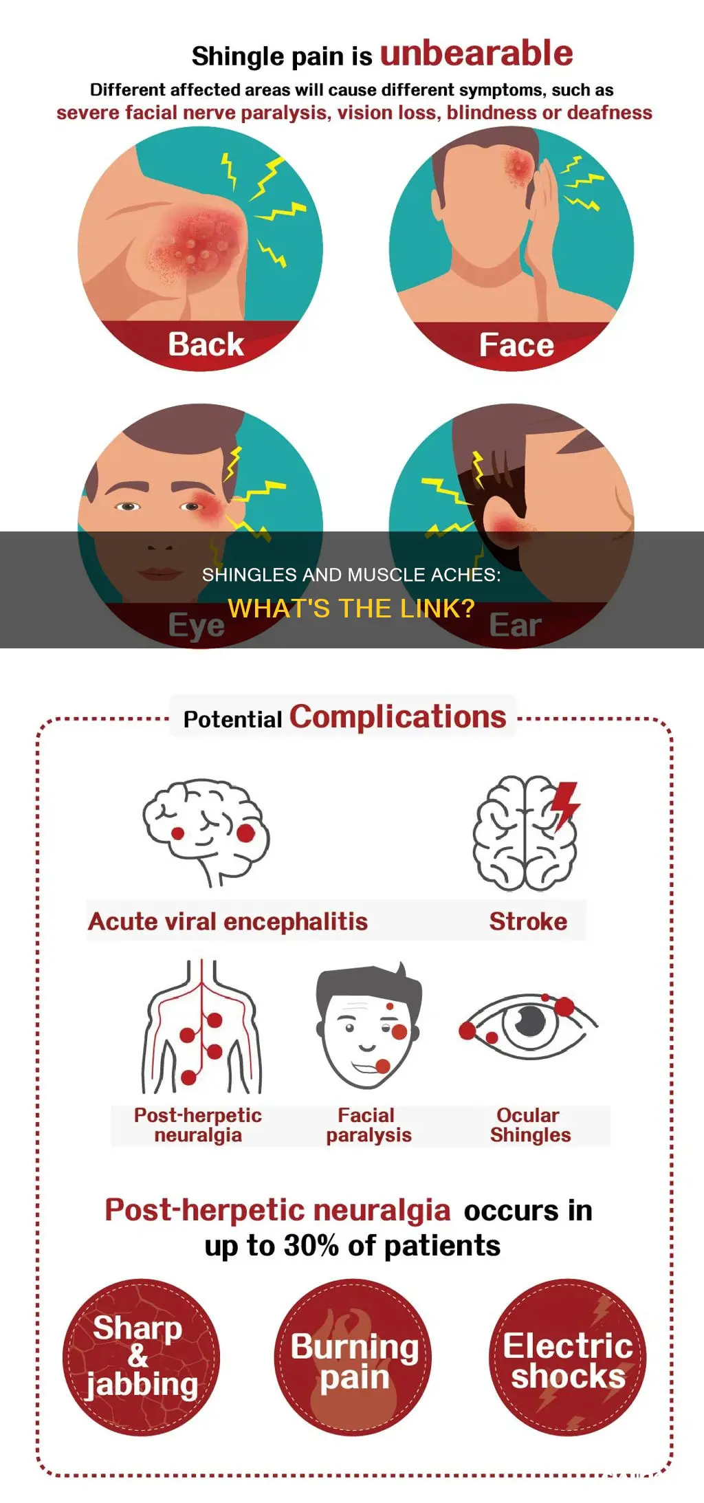 does shingles cause muscle aches