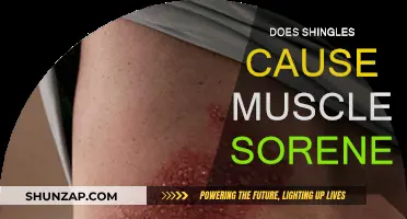 Shingles and Muscle Soreness: What's the Link?