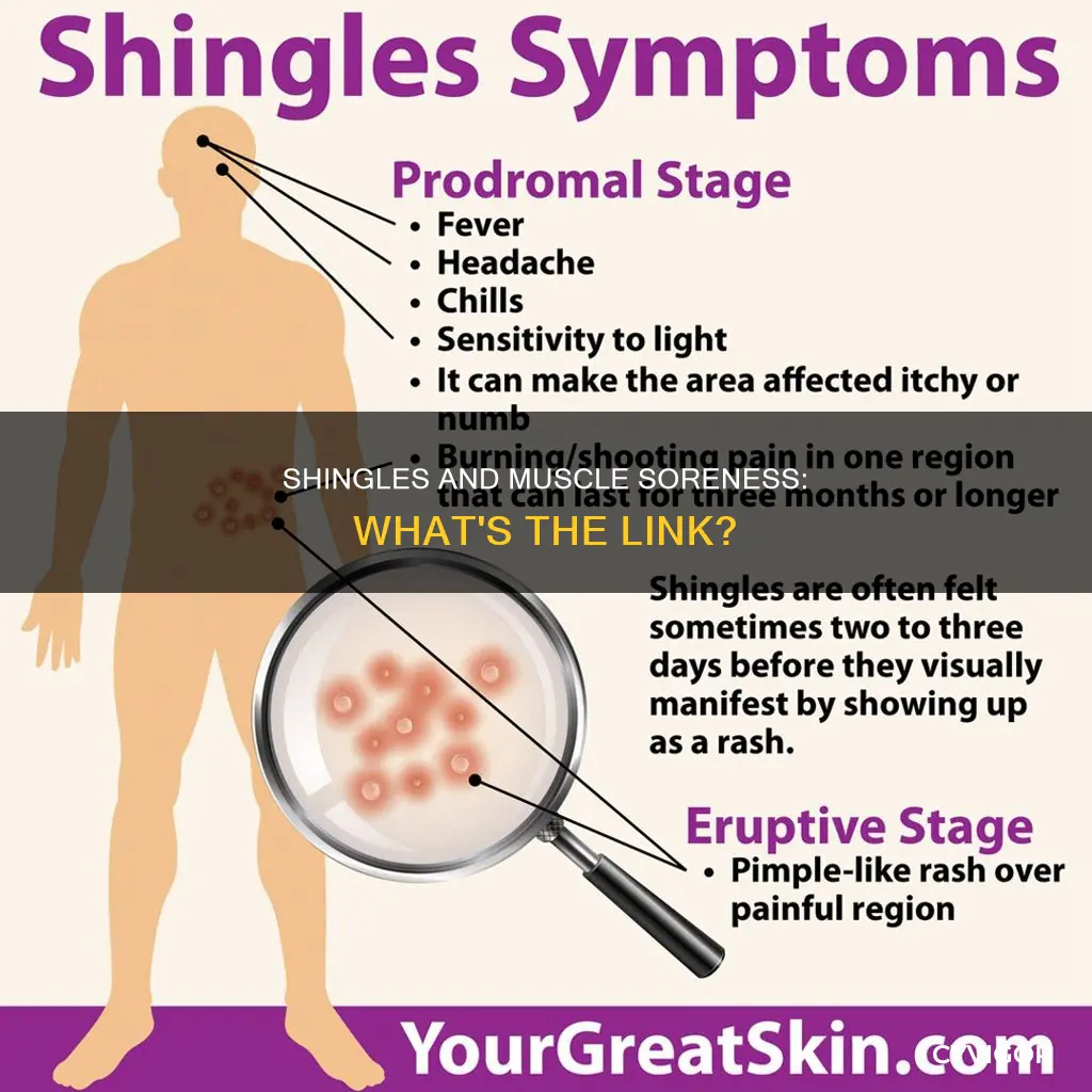 does shingles cause muscle soreness